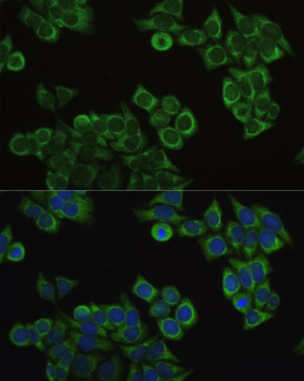 Anti-ECHS1 Antibody (CAB3845)