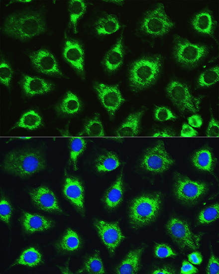 Anti-ATG16L1 Antibody (CAB11969)