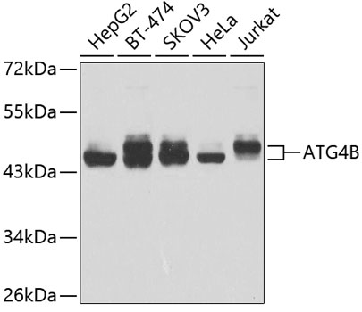 Anti-ATG4B Antibody (CAB2837)