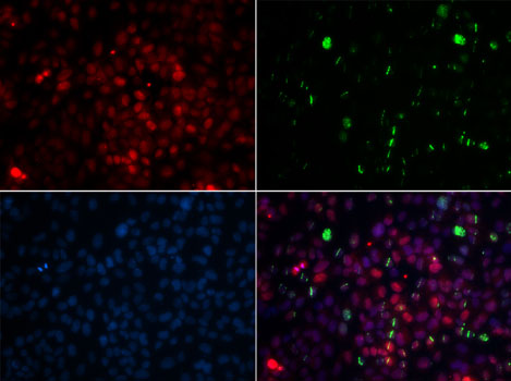 Anti-CETN2 Antibody [KO Validated] (CAB5397)