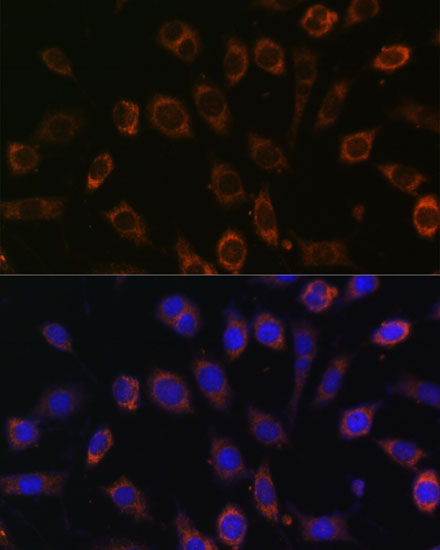 Anti-TCIRG1 Antibody (CAB15382)