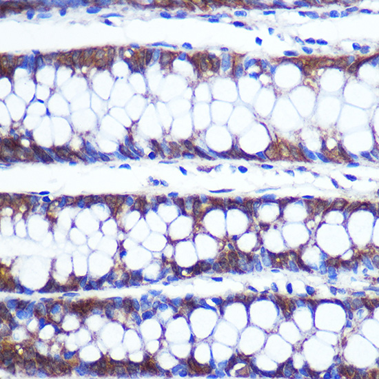 Anti-TOP1MT Antibody (CAB15559)