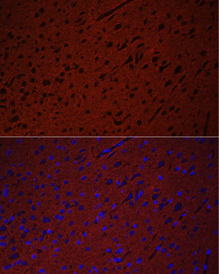 Anti-STXBP1 Antibody (CAB5420)