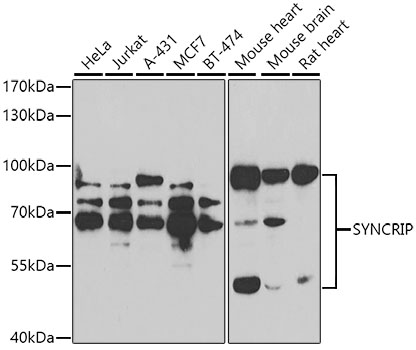 Anti-SYNCRIP Antibody (CAB7219)