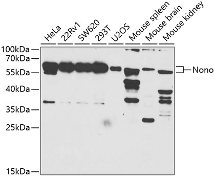 Anti-NONO Antibody (CAB5282)