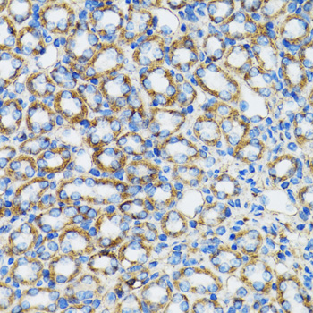 Anti-Alpha-Catenin Antibody [KO Validated] (CAB5635)