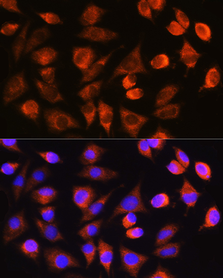 Anti-Caspase-3 Antibody (CAB0214)