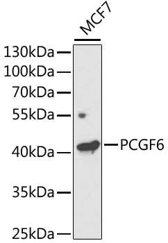 Anti-PCGF6 Antibody (CAB5760)