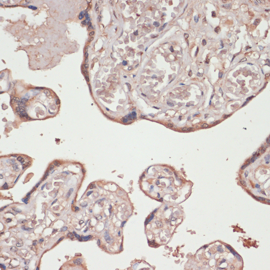 Anti-TXNRD1 Antibody (CAB16631)