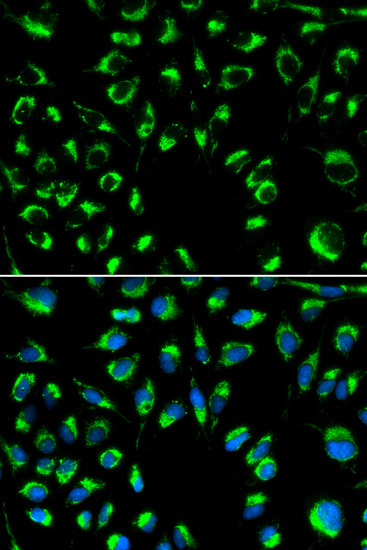 Anti-PPP4C Antibody (CAB2109)