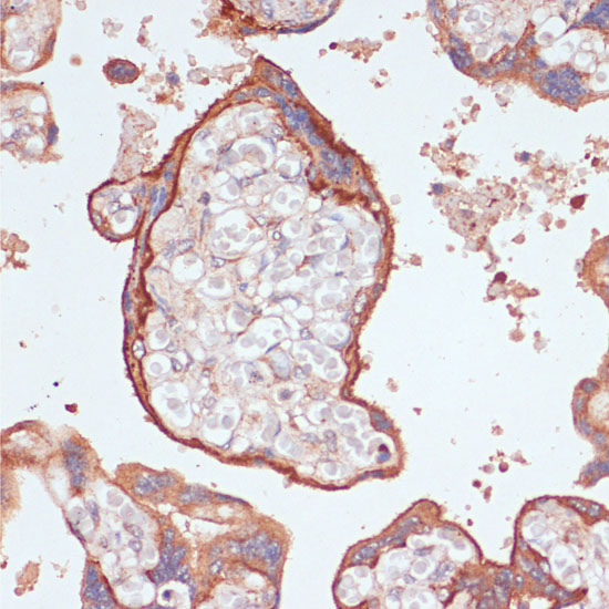 Anti-IL-6ST Antibody (CAB14656)