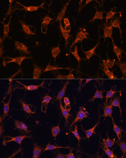 Anti-Akt2 Antibody (CAB1250)