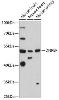 Anti-DNPEP Polyclonal Antibody (CAB9064)