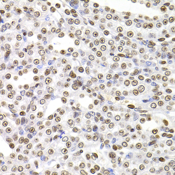 Anti-SOX5 Antibody (CAB6985)