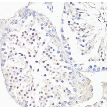 Anti-GLI1 Antibody (CAB14675)