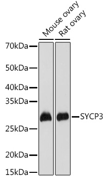 Anti-SYCP3 Polyclonal Antibody (CAB9548)