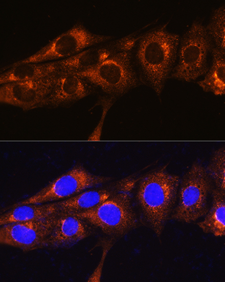 Anti-FREM2 Antibody (CAB15980)