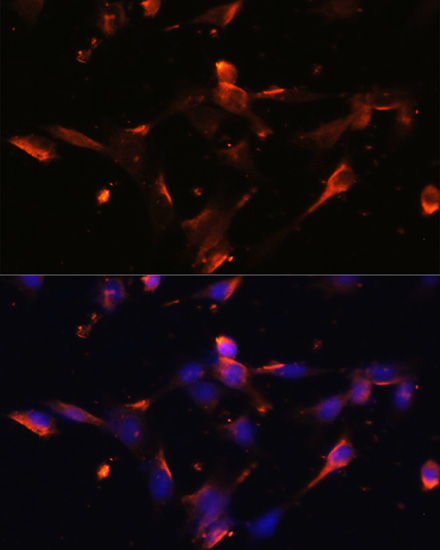 Anti-CLDN5 Antibody (CAB10207)