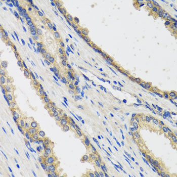 Anti-RAD51C Antibody (CAB6961)