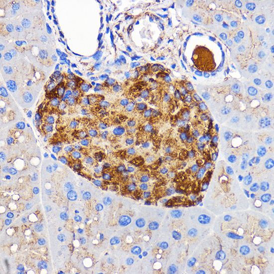 Anti-IAPP Antibody (CAB2816)