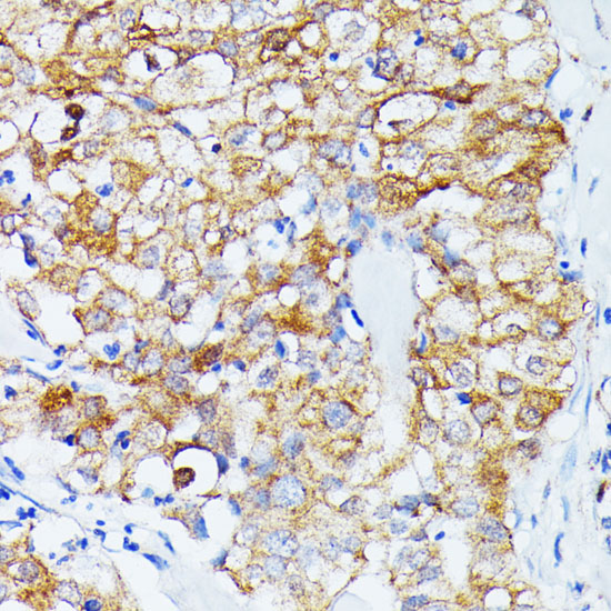 Anti-ECE1 Antibody [KO Validated] (CAB5638)