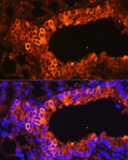 Anti-KRT7 Antibody (CAB12004)