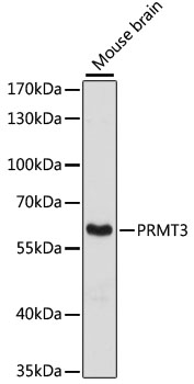 Anti-PRMT3 Antibody [KO Validated] (CAB13068)