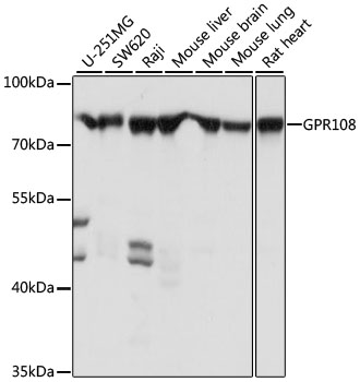 Anti-GPR108 Antibody (CAB16554)