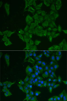 Anti-LGALS3BP Antibody (CAB6929)