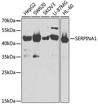 Anti-SERPINA1 Antibody (CAB1015)