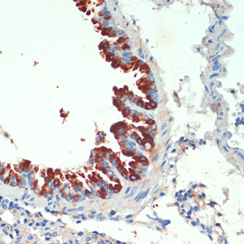 Anti-KIF5B Antibody (CAB15284)