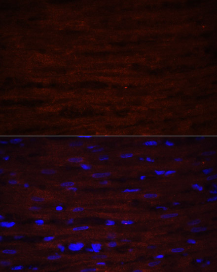 Anti-ASPN Antibody (CAB10311)