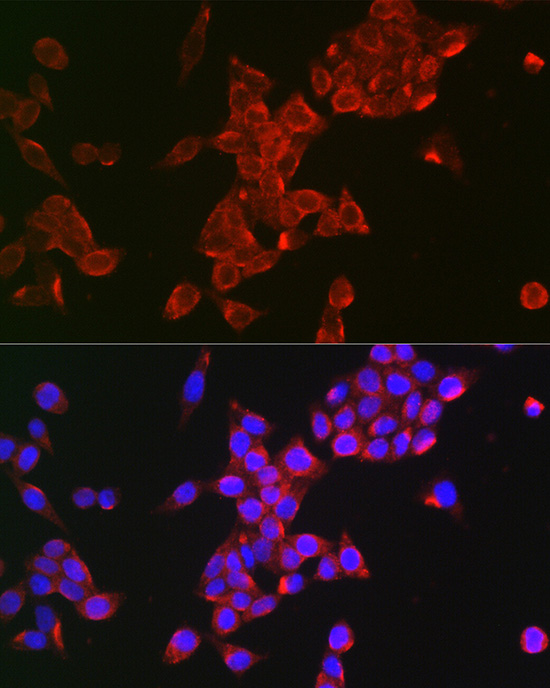 Anti-FSHR Antibody (CAB1480)