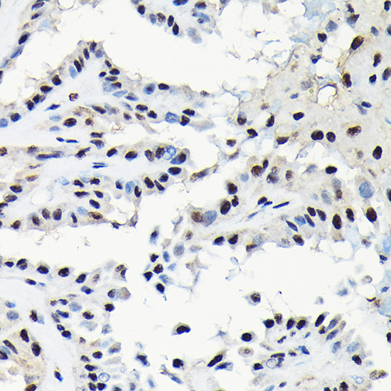 Anti-EFTUD2 Antibody (CAB7040)