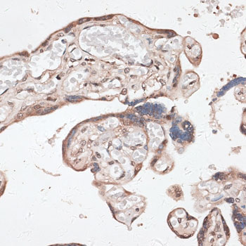 Anti-SPDEF Antibody (CAB14114)