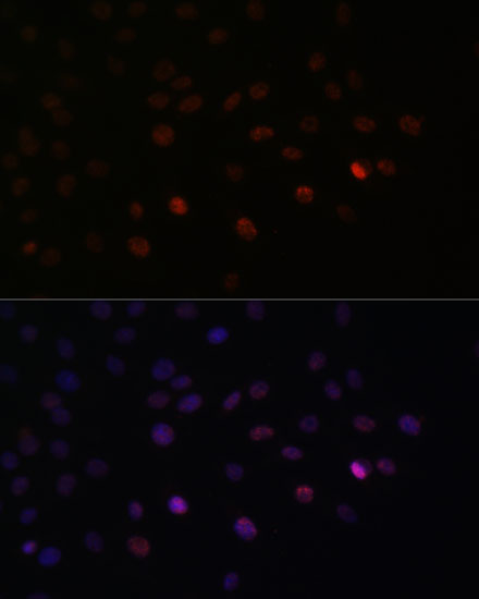 Anti-SRSF3 Antibody (CAB6067)