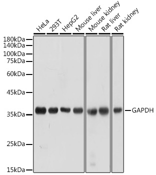 Anti-GAPDH Antibody (CABC027)