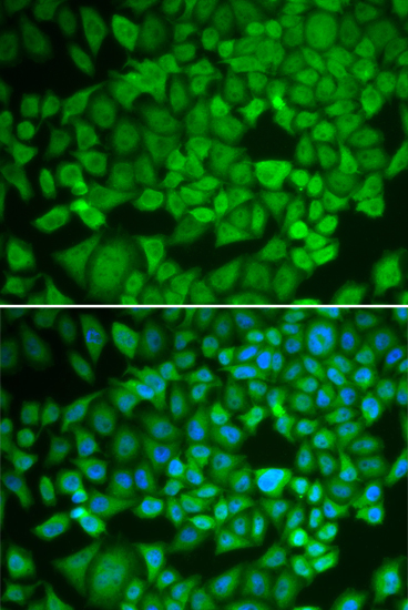 Anti-NR0B1 Antibody (CAB1740)