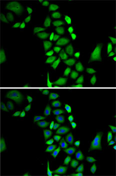 Anti-GLO1 Antibody (CAB1932)