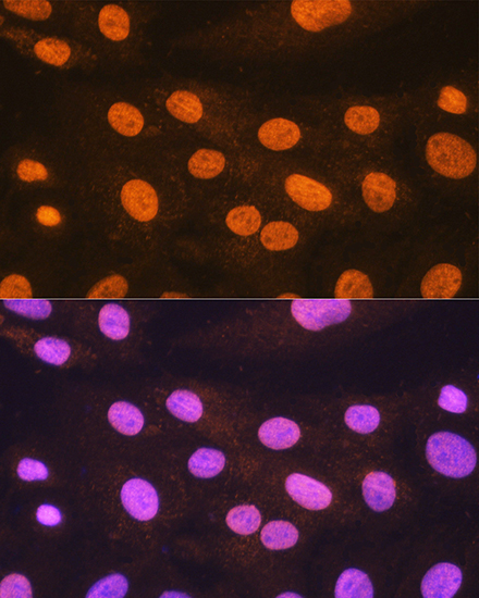 Anti-POLR2A Antibody (CAB2107)