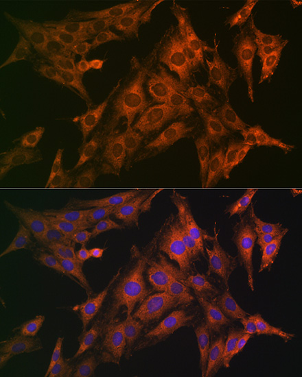 Anti-Caspase-1 Antibody (CAB0964)