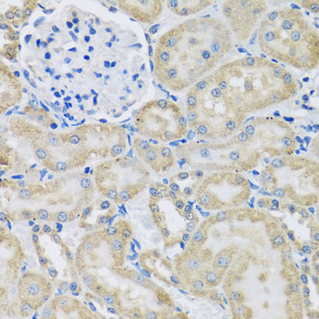 Anti-DCP2 Polyclonal Antibody (CAB8282)