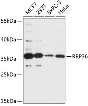 Anti-RRP36 Antibody (CAB14328)