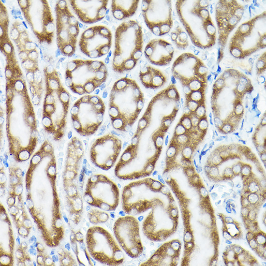 Anti-EEF1A1 Antibody (CAB17857)