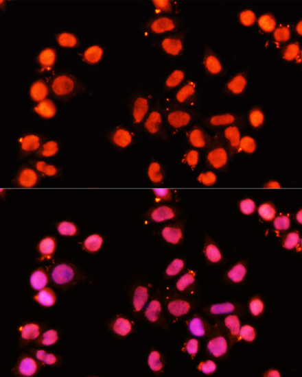 Anti-XRCC1 Antibody (CAB0442)