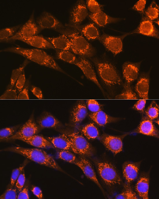 Anti-CFP Antibody (CAB5398)