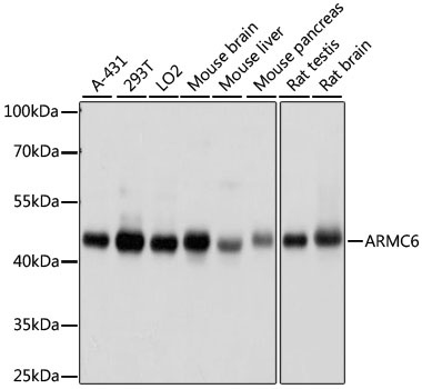 Anti-ARMC6 Antibody (CAB15931)