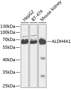 Anti-ALDH4A1 Antibody (CAB13569)