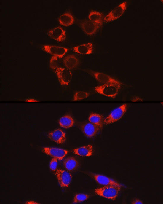 Immunofluorescence analysis of NIH/3T3 cells using GSDMD Rabbit mAb at dilution of 1:100 (40x lens). Blue: DAPI for nuclear staining.