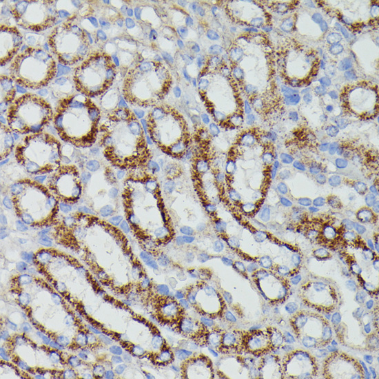 Anti-NDUFAB1 Antibody (CAB14657)